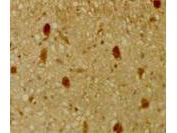 Anti-p130 (Rb2) Antibody - Immunohistochemistry