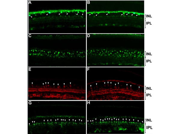 Immunofluorescence using DAB1