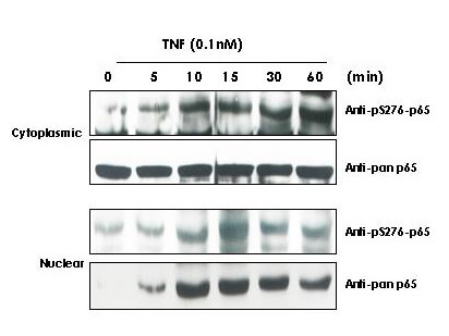 Western Blot - Anti-NFKB p65 (Rel A) pS276 Antibody