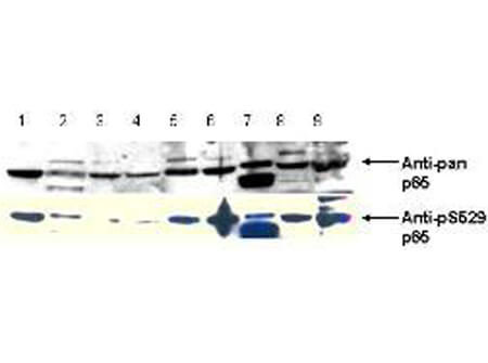 Western Blot of Anti-NFKB p65 (Rel A) pS529 Antibody