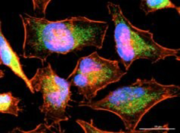 Immunofluorescence using AKT