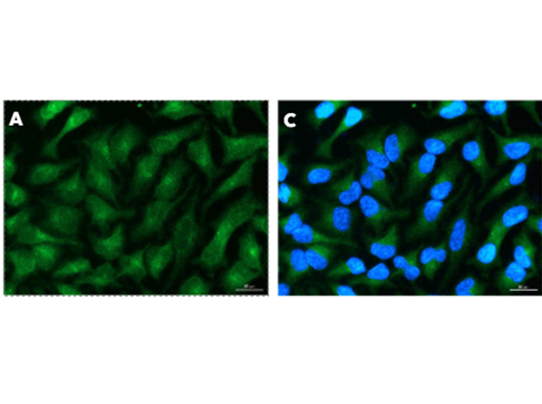 Immunofluorescence using AKT