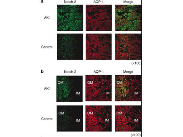 Immunohistochemistry of cleaved Notch-2
