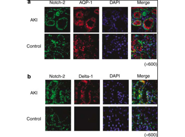 Immunohistochemistry of cleaved Notch-2
