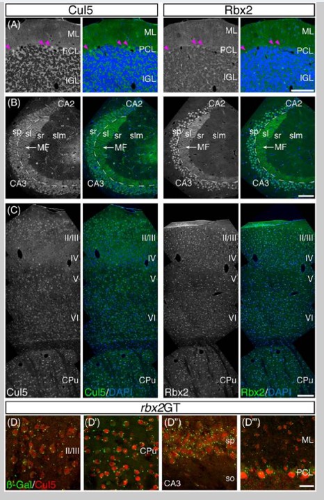 Immunofluorescence of Cul5