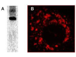 Anti-nsp8 Antibody - Western Blot and Immunofluorescence