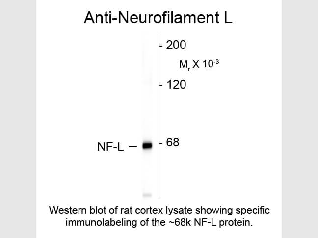 Western blot of Anti-Neurofilament L (Mouse) Antibody - 200-301-D83