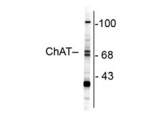 Western Blot - Anti-Choline Acetyltransferase Antibody