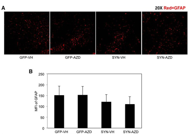 Immunohistochemistry of GFAP