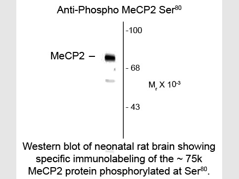 Western Blot of Anti-MeCP2 pS80 (Rabbit) Antibody - 100-401-D71
