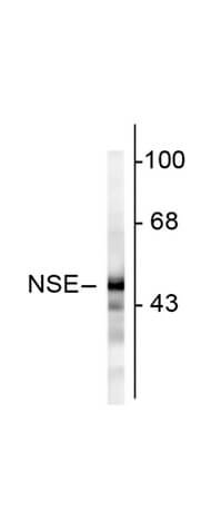 Western Blot - Anti-Neuron specific enolase (NSE) antibody