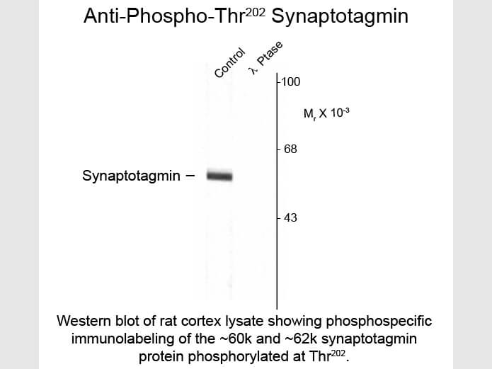 Western blot of Anti-Synaptotagmin pT202 (Rabbit) Antibody - 612-401-E38