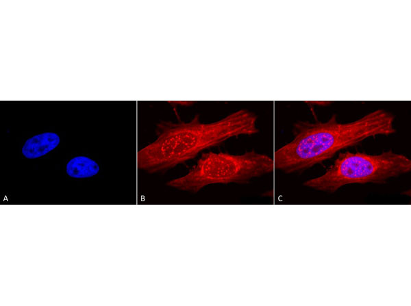 Immunofluorescence of Rabbit Anti-Alpha B Crystallin Antibody