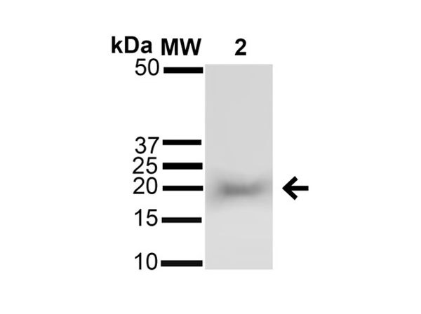 Western blot of Alpha B Crystallin