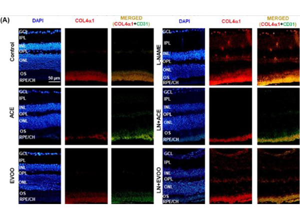 Immunofluorescence of CD31