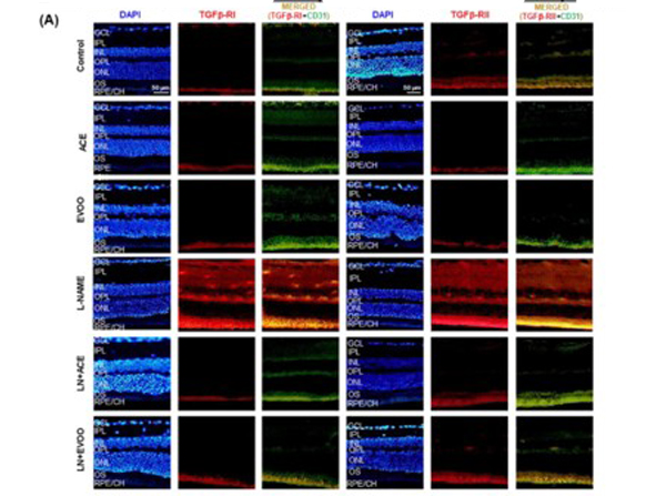Immunofluorescence of CD31