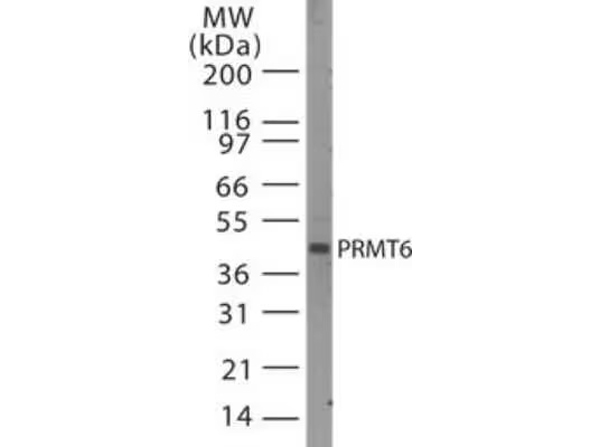 Western Blot analysis of Anti-PRMT6 Antibody