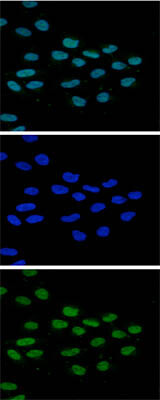 Immunofluorescence Microscopy of anti-JMJD2b antibody