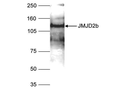 Western Blot of anti-JMJD2b antibody