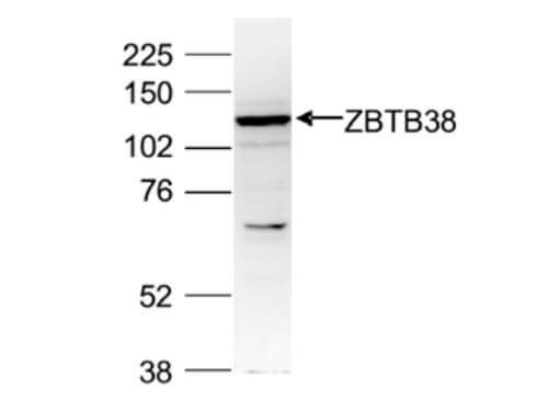 Western Blot of anti-ZBTB38 antibody