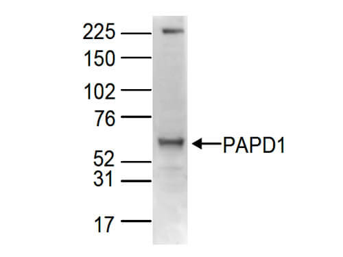 Western Blot of anti-PAPD1 antibody