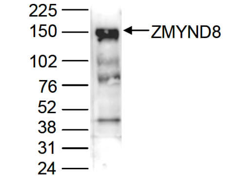 Western Blot of anti-ZMYND8 antibody