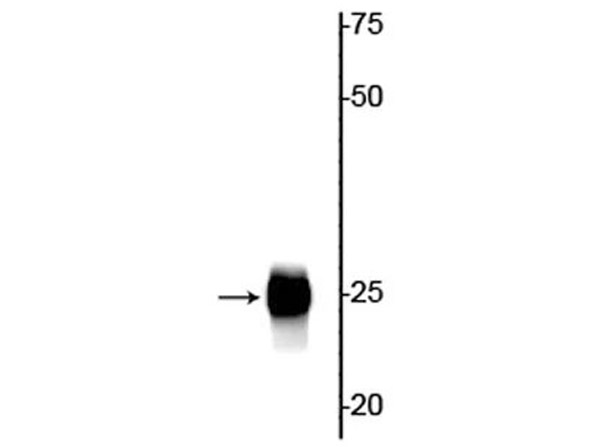 Western blot of anti-troponin I antibody