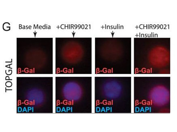 Immunofluorescence of betaGal