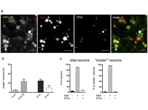 Immunofluorescence of betaGal