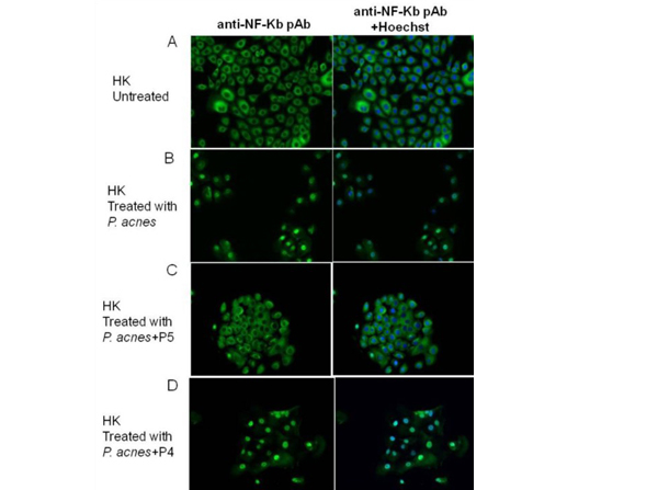 Immunofluorescent NFKB p65