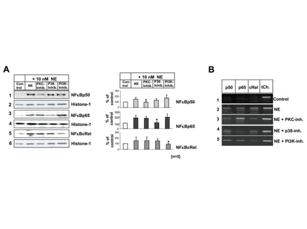 Western Blot and ChIP results using NF-κB
