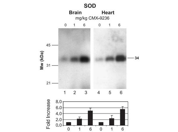 Western Blot of Anti-Superoxide Dismutase (RABBIT) Antibody