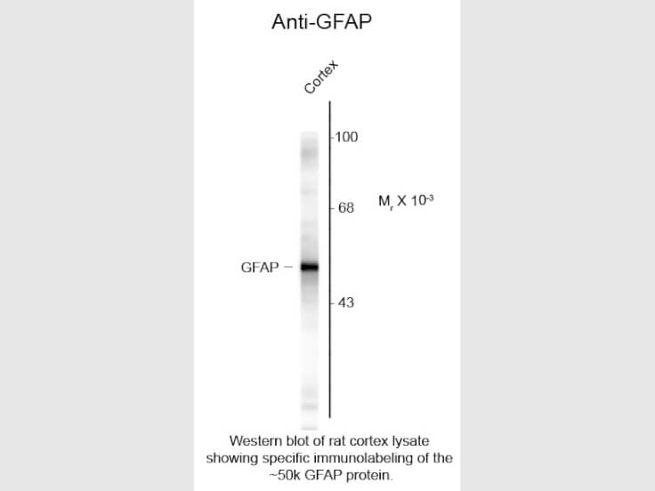 Western Blot of Anti-Glial Fibrillary Acidic Protein (GFAP) (Rabbit) Antibody - 101-401-D60
