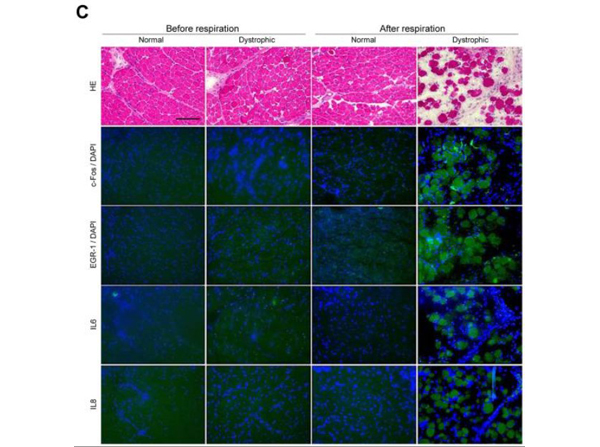 Immunofluorescence using IL8