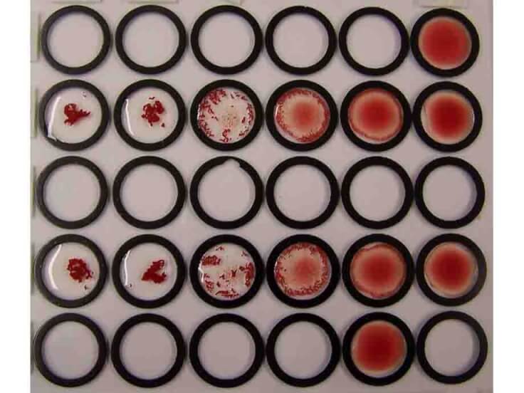 Human Red Blood Cell RBC Antibody
