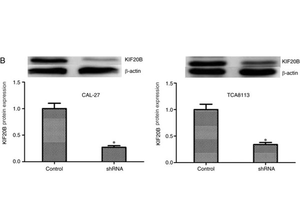 Western Blot results using Goat Anti-Mouse IgG Fc