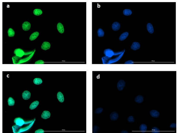 Immunofluorescence microscopy using Fluorescent TrueBlot® anti-rabbit IgG