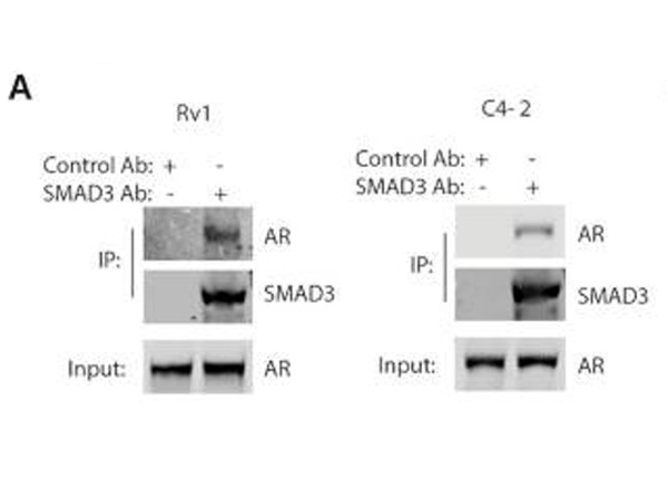 Immunoprecipitation using TrueBlot Rabbit IgG HRP