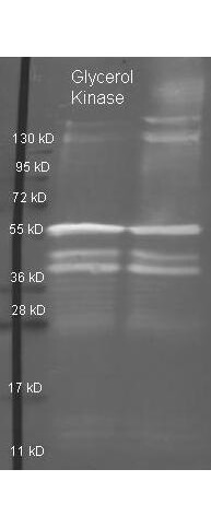 Glycerol Kinase Polyclonal Antibody-Western blot