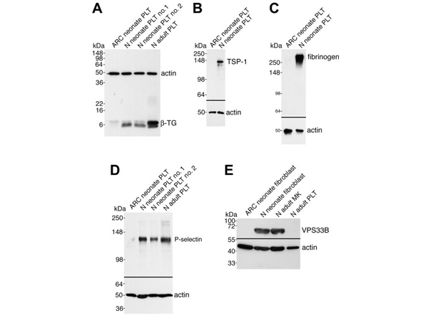 Western Blot using Fibrinogen
