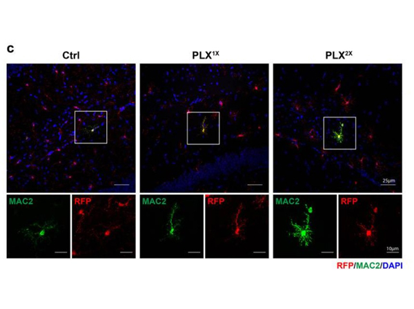 Immunofluorescence using RFP