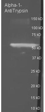 Alpha-1anti-Trypsin Polyclonal Antibody-Western blot