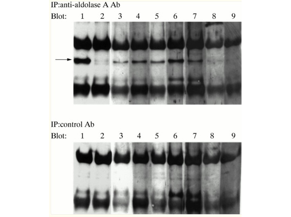 Immunoprecipitation using Aldolase
