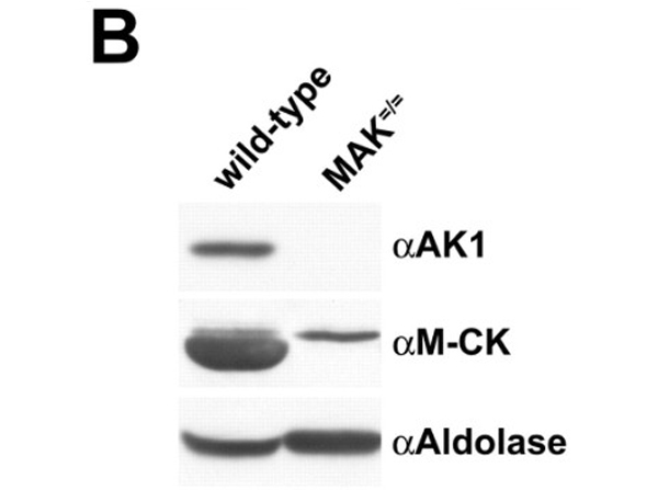Western blot using Aldolase