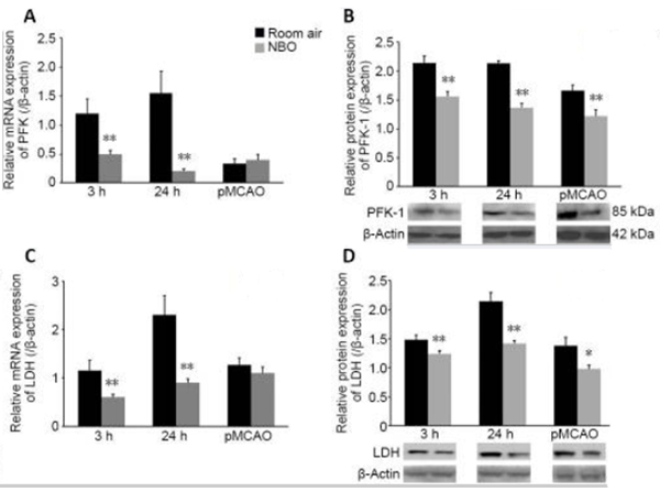 Western blots using PFK-1