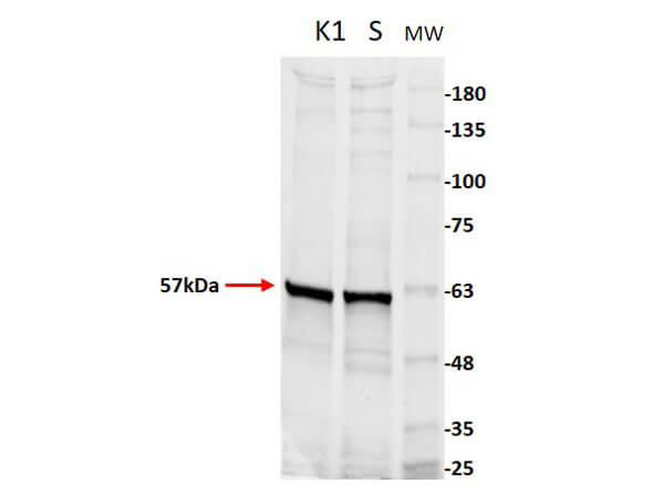 Western Blot of Anti-Pyruvate Kinase Antibody