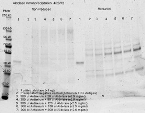 Anti aldolase antibody– Immunoprecipitation