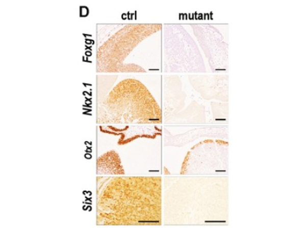 Immunohistochemistry using Six3