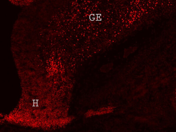 Immunofluorescence of Guinea Pig Anti-Six 3 Antibody