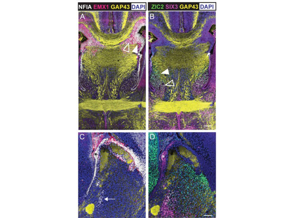Immunofluorescence using Six3